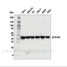 CST beta-Actin兔單克隆抗體 4970T