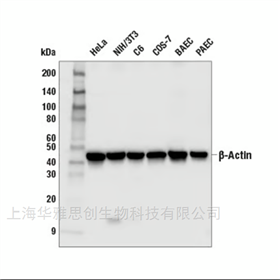 CST beta-Actin兔單克隆抗體 4970T