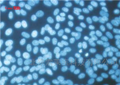 CA1080支原體檢測試劑盒