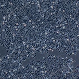 人口腔鳞癌细胞PE/CA-PJ41(STR鉴定正确)