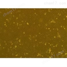 小鼠原代B淋巴細(xì)胞
