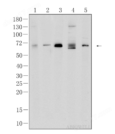 image.png 艾碧維KiSS-1R兔多克隆抗體