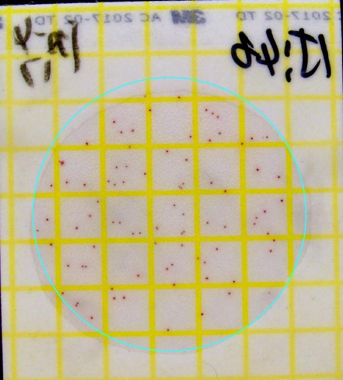 菌落總數(shù)計(jì)數(shù)前.JPG GB 4789.3下周實(shí)施!大腸菌群計(jì)數(shù)將有哪些新變化?