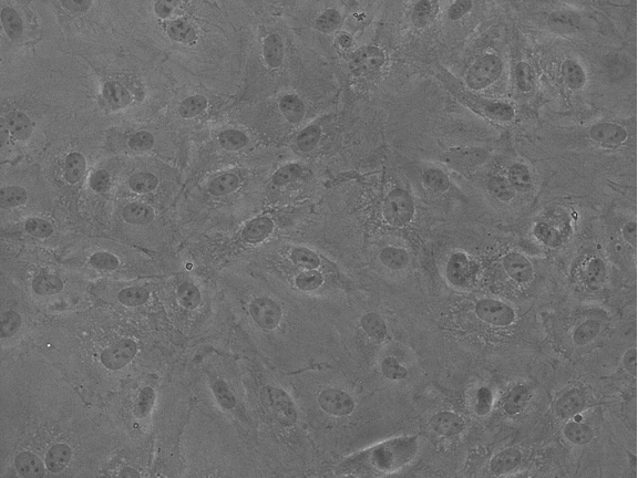 LONZA原代人主动脉内皮细胞HAEC和内皮培养基产品介绍